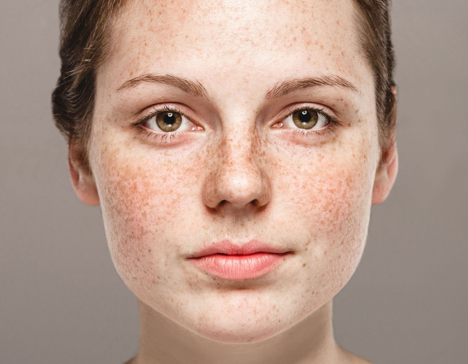 Can Lupus Cause Weight Gain? A Simple and Clear Guide