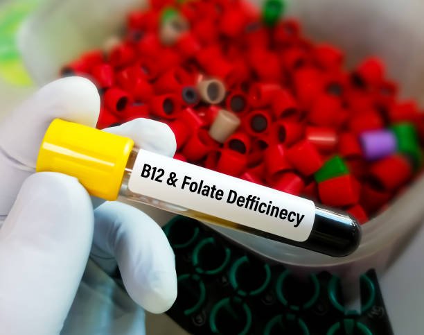 B12 Deficiency Symptoms: Key Signs That Every Woman Should Know