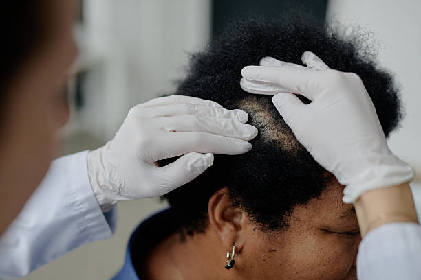 What Causes Hair Loss in Women: Root Causes and Real Fixes